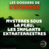 Mystères sous la peau : Les implants extraterrestres